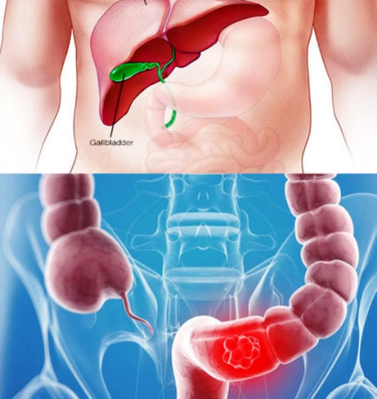 stomize-tajasuchana-