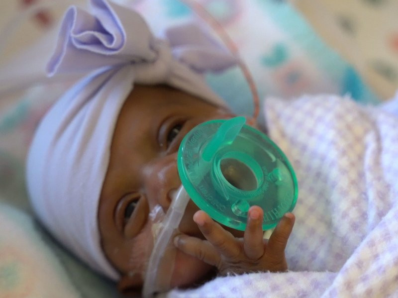 like apple sizw baby