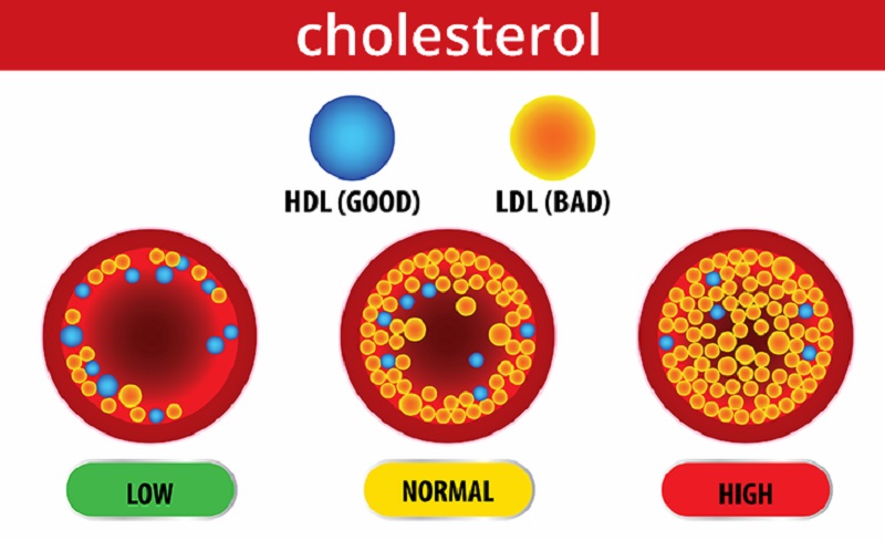 cholesterol-graphic-2