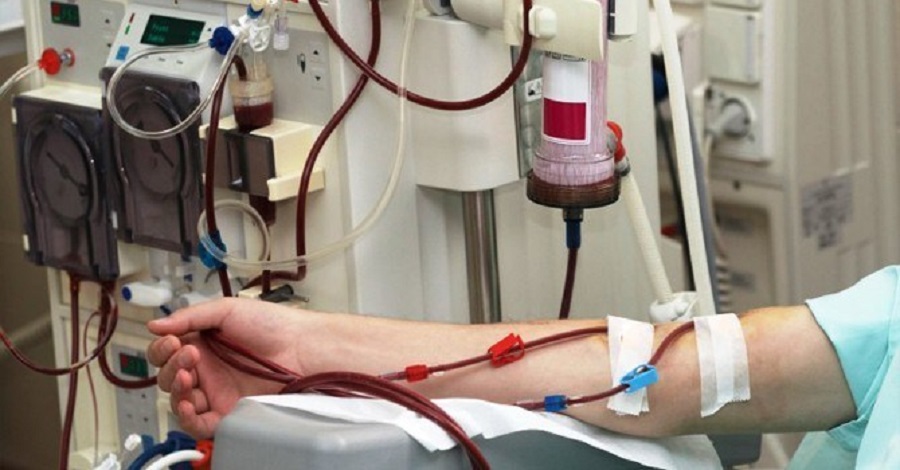 Dialysis-1