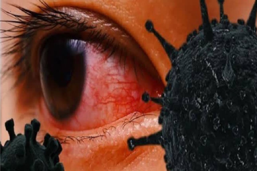 eye-corona-kalo dhusi