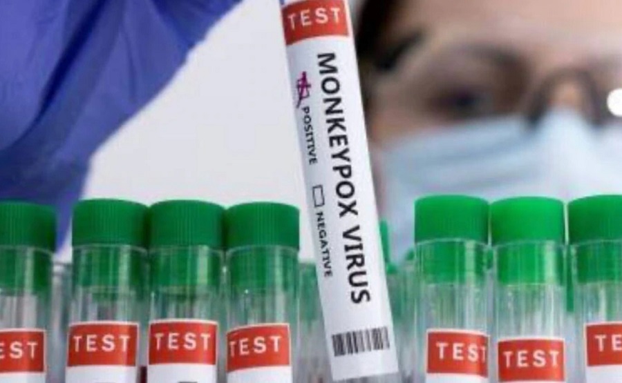 monkeypox